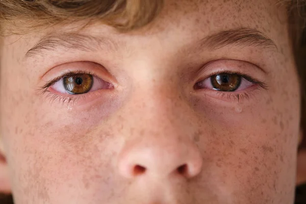Zbliżenie Zboża Zdenerwowany Chłopiec Brązowymi Oczami Łzami Twarzy Patrząc Aparat — Zdjęcie stockowe