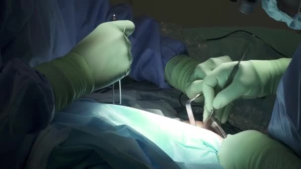 Klinikte Ameliyat Yaparken Tıbbi Retraktörler Kullanan Önlüklü Lateks Eldivenli Isimsiz — Stok video