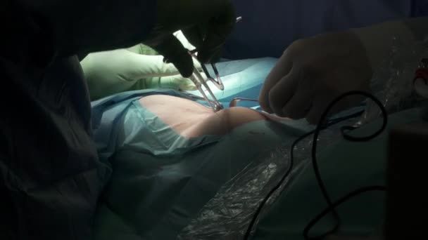 Gewas Onherkenbare Chirurgen Latex Handschoenen Met Behulp Van Tang Schaar — Stockvideo