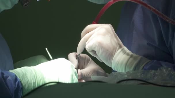 Seitenansicht Anonymer Chirurgen Latexhandschuhen Und Uniformen Mit Blutsaugrohr Und Pinzette — Stockvideo