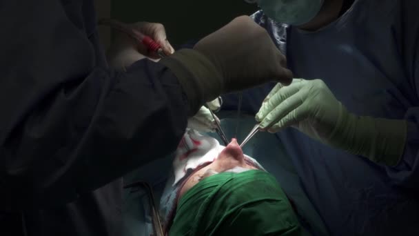 应用医用针头架和注射器在鼻成形术中应用无法辨认的 头戴制服和口罩缝合切口的男性整形外科医生侧视 — 图库视频影像
