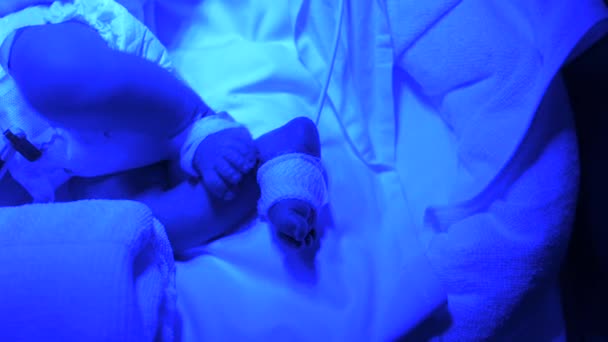 Yukardan Gelen Hasta Bebek Hastanede Hafif Terapi Için Ultraviyole Altında — Stok video