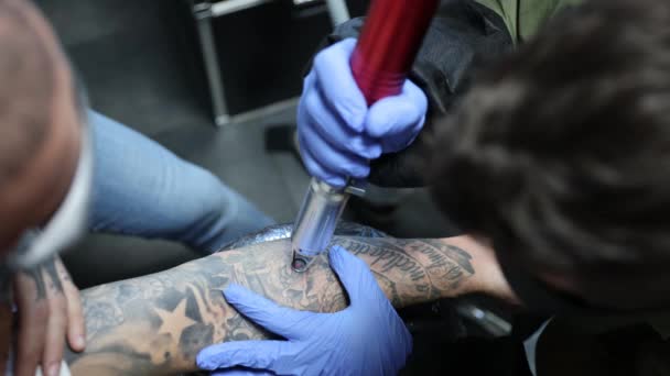 Shora Anonymní Tetovací Mistr Rukavicích Odstraňující Tetování Paži Člověka Pomocí — Stock video