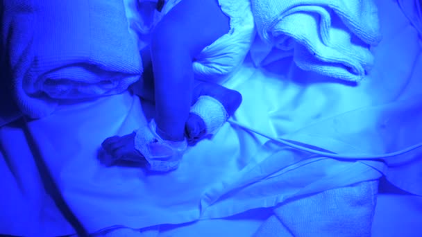 Csecsemőinkubátorban Fekvő Beteg Csecsemő Oldalnézete Újszülött Intenzív Osztályon Ultraibolya Fényterápia — Stock videók
