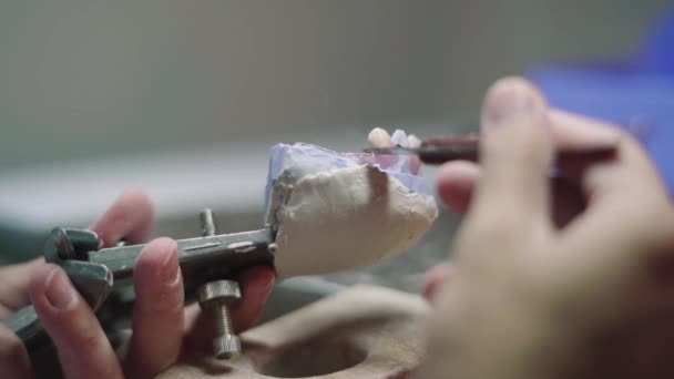 在实验室生产假牙时 用石膏嘴和瓷牙制作的无法辨认的男主人的假牙 — 图库视频影像