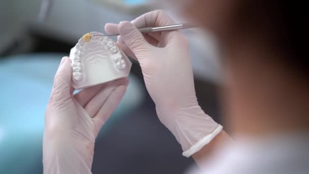 Crop Ortodontista Irreconhecível Com Ferramentas Cirúrgicas Fazendo Molde Mandíbula Para — Vídeo de Stock