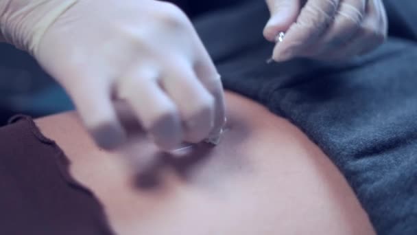 Žena Piercing Proces Speciálním Vybavením Kosmetickém Centru Lékaře — Stock video