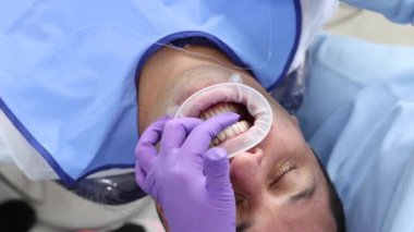 Klinikte profesyonel diş bakımı alan adamın yakın plan görüntüleri.