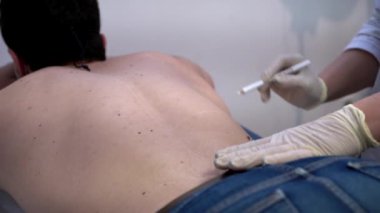 Güzellik kliniğinde lazer tüy temizlemeye hazırlanırken erkek müşterinin sırtına tanınamaz hale gelen ana çizikler.