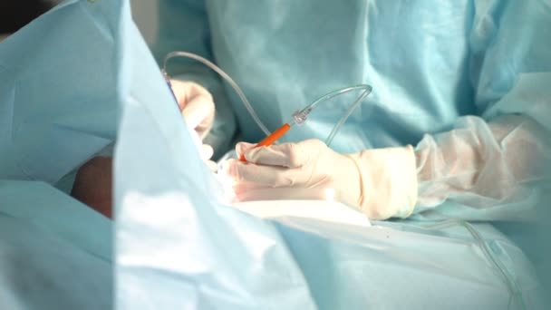 Boční Pohled Chirurgy Latexových Rukavicích Uniformách Provádějící Operace Klinice — Stock video