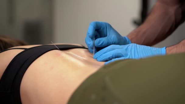 头戴乳胶手套的无法辨认的女医生 为躺在诊所病床上的女病人进行针灸治疗 — 图库视频影像