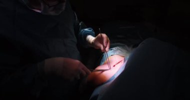 Ameliyat sırasında ameliyathanedeki cerrahların yakın görüntüsü.