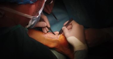 Ameliyat sırasında ameliyathanedeki cerrahların yakın görüntüsü.