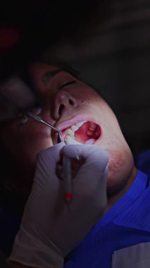 Eldiven takan bir diş hekimi, klinik ortamlarda diş temizliği ve sağlığını sağlamak için özel aletler kullanarak hastaya diş temizleme prosedürü uygular.