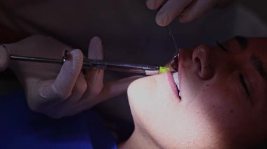 Bir hasta diş sağlığı kliniğinde profesyonel diş temizliği alır ve diş hijyenisti diş sağlığı ve diş sağlığı için optimum oranın sağlanması için özel aletler kullanır.