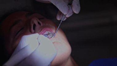 Eldivenler konusunda uzman bir diş hekimi diş temizleme prosedürü uygulamak için özel aletler kullanır, plağın çıkarılması ve sağlıklı, temiz dişler için ağız hijyeninin sağlanması üzerine odaklanır.