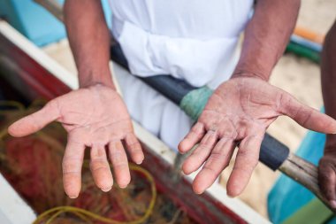 Sri Lanka 'daki bir balıkçının avuçlarında El İşi İşaretleri Gösteriliyor