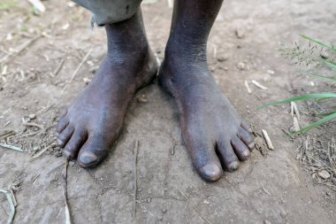 Çıplak Ayaklı Afrikalı Adam Toprakta Duruyor, Ugand