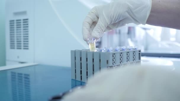 在实验室的研究中 医务工作者用血样和尿样安装了试管 体格检查临床诊断 — 图库视频影像
