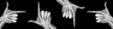 Film xray x-ray or radiograph of a thumb and finger in gestural language, manual communication, or signing aka sign language, pointing this way or that way in four directions, up, down, left, right clipart