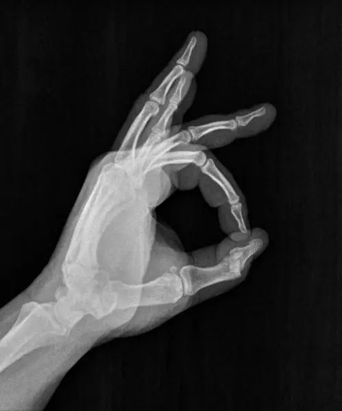 Film xray x-ray or radiograph of a thumb and finger circle associated with ok, agreement, approval, confirmation or positivity in gestural language, manual communication, or signing aka sign language