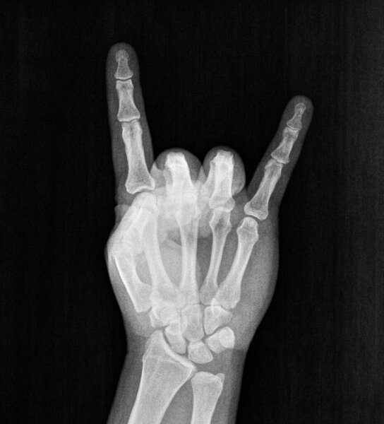 Film xray x-ray or radiograph of hand and fingers showing bones doing the sign language gesture for rock on devil horn seen at heavy metal and rock n roll concerts by audience members to show approval