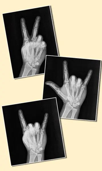 Film xray x-ray or radiograph of a hand and fingers showing the peace hippie 1960s groovy sign or V, I love you, rock on devil horn.  aka peace, love and rock n roll.  isolated on white background