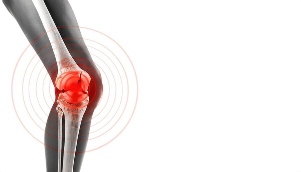 Скелетный вид боли в коленях с красным источником тепла, чтобы показать область. колено с изображением рентгеновского типа. Боль в колене - концепция спортивных травм на белом фоне с копировальным пространством
