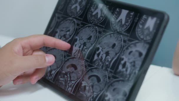 医生在医院咖啡店检查脑部扫描的测试结果 专业医生在诊所餐厅使用数字平板电脑观看Mri或Ct扫描图像 医护人员有制动器 — 图库视频影像