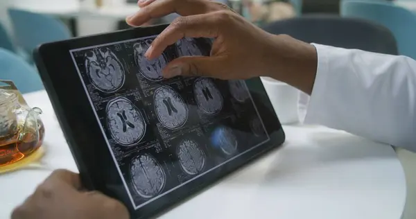 Afroamerikansk Läkare Bläddrar Igenom Bilder Mrt Eller Datortomografi Digital Tablett — Stockfoto