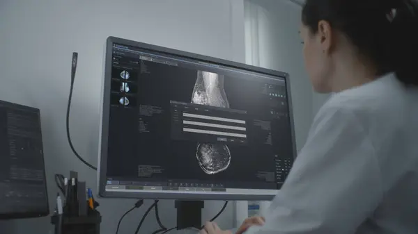 Profesionální Lékařka Zkoumá Výsledky Mamografického Screeningu Pomocí Počítače Mamograf Skenuje — Stock fotografie