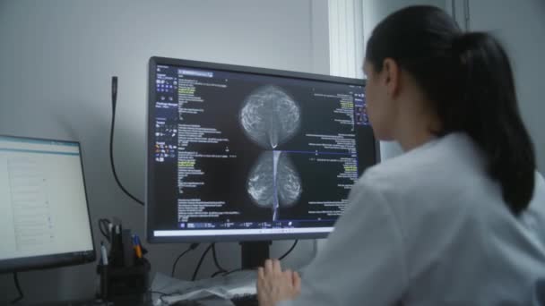 Zaporizhya Ukraine Oktober 2022 Professionell Kvinnlig Läkare Undersöker Resultaten Mammografiscreening — Stockvideo