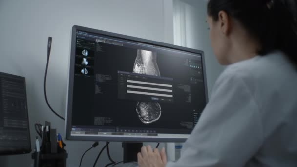 Professionelle Ärztin Untersucht Die Ergebnisse Des Mammographie Screenings Computer Mammographie — Stockvideo