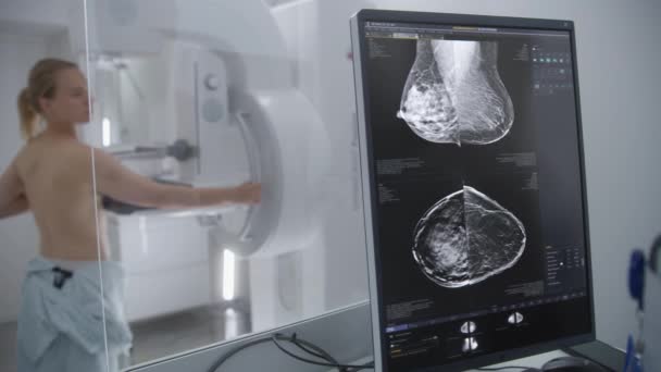 大人の女性は 病院の放射線科室でマンモグラフィ検査を受けているトップレスの立場です マンモグラフィー機械を活性化するためのコンピュータ制御パネル画面 乳がん予防について 現代クリニック — ストック動画