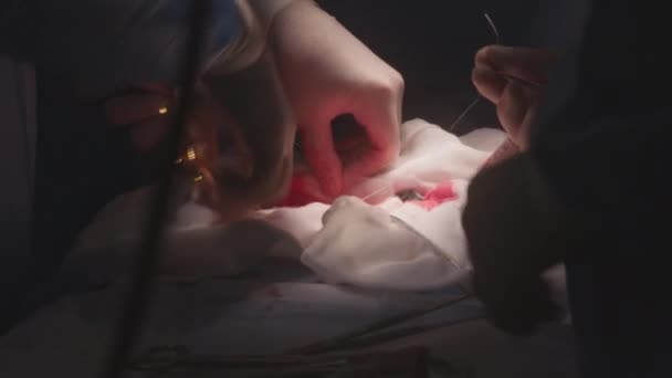 近距离专业外科医生缝线切割 医生在手术室里给病人做手术 护士协助医生 准备和提供医疗器械 在医疗中心工作的医务人员 — 图库视频影像