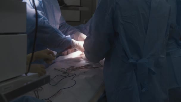 外科スーツの専門外科医の閉鎖は 手術で患者を操作する 看護師は 医師に道具を与え 吸収性の綿を変更する 女性の医学はモニターの患者の状態を点検します — ストック動画