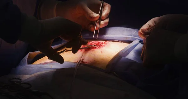 커트를 바느질하는 직업적인 외과의사의 의학은 수술실에서 환자를 수술합니다 간호사는 의사를 — 스톡 사진