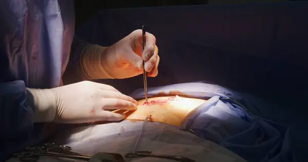 手术快结束了专业外科医生用医疗夹和镊子剪断缝合线 年轻护士协助医生 并提供医疗仪器 在现代医疗中心工作的医务人员 — 图库照片