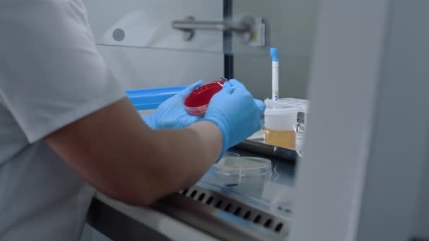 Női Tudós Vizeletvizsgálattal Dolgozik Mintát Terjeszt Petri Csészén Biokémiai Elemzésre — Stock videók