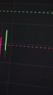 Profesyonel ticaret uygulamasının görüntülü arayüzü olan bilgisayar monitörü. Japon şamdanı animasyonlu borsa grafiği. Monitördeki hisse senetlerinin ekonomik grafikleri yükselip alçalıyor. Dikey