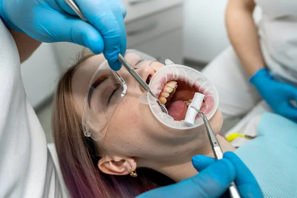 Professionelle Mandlige Kvindelige Tandlæger Behandler Kvindes Tænder Tandlæge Kontor Ansigt - Stock-foto