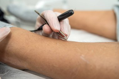 closeup of electro epilation procedure for removal hair from female client legs in beauty cabinet. Cosmetology and healthy lifestyle