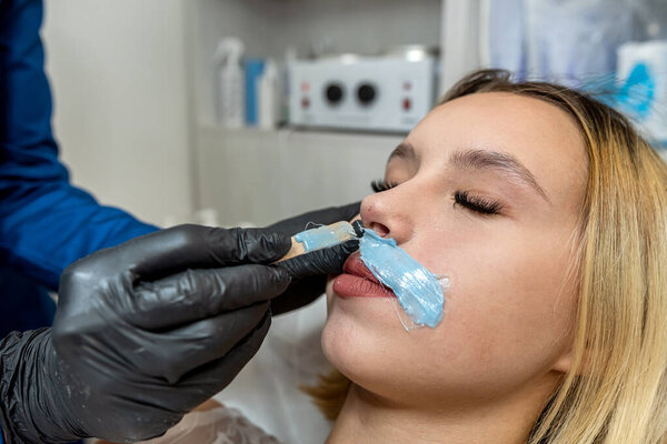 Beautician is removing hair mustache on lip female client face with wax hot sugar on spa salon. Epilation concept