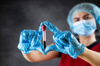 Kadın hemşire ya da doktor kırmızı üniforma giyiyor ve üzerinde koronavirüs COVID-19 izole edilmiş kan testi sonuçları var. Tıbbi araştırma