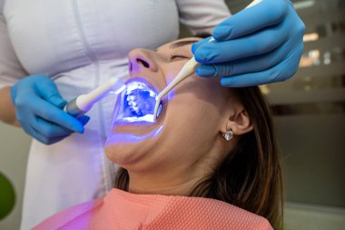 Diş hekimi, dişlerini beyazlatmak için mor ötesi lamba ve fotopolimer karışımı kullanıyor. Diş sağlığı ve sağlık hizmetleri kavramı