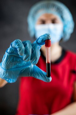 Kırmızı üniformalı doktor ve koruyucu bez elinde COVID-19 analizi için kan örneğiyle test tüpü tutuyor. Tıbbi test tüpleri