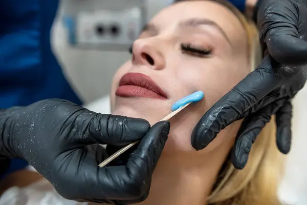 Beautician doing treament procedure with hot wax on lip in young woman face in spa clinic. Depilation or epilation for removing hair