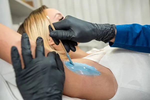 medical master depilatioin doing procedure of epilation of hair removal from the armpit with hot wax sugar pasta. Clear skin and health care concepts.