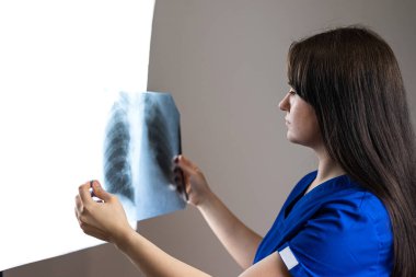 Kafkas kadın doktor klinikte röntgen akciğerlerini inceliyor. Sağlık hizmetleri, tıbbi meslek