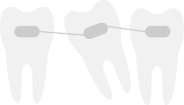 Bu illüstrasyonda biri yanlış dizilmiş üç diş var. Dişlerin üzerinde parantez var. Bu da ortodontik tedavi için diş teli taktıklarını gösteriyor..